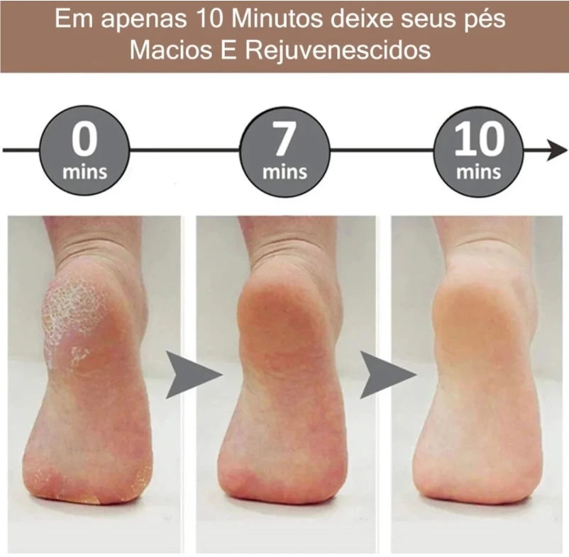Lixadeira Elétrica - FootCare Pro - Pele lisa e Saudável